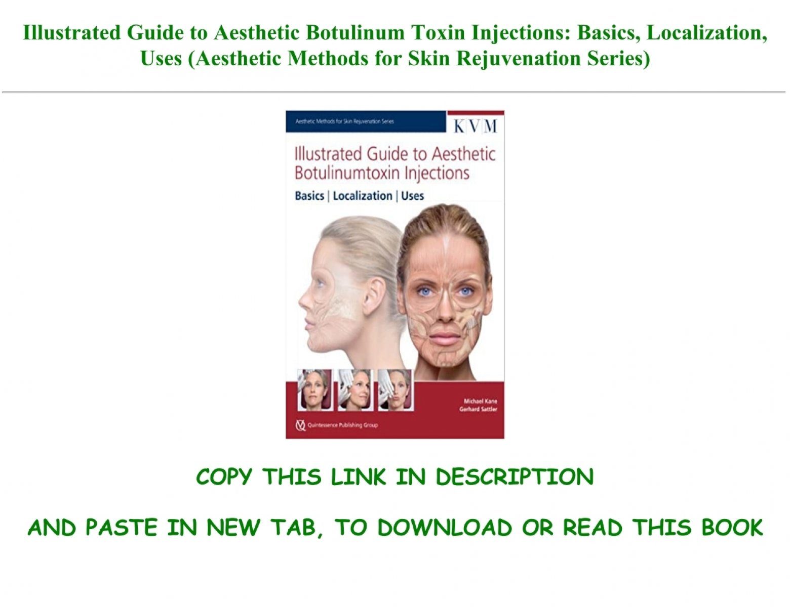 illustrated guide to aesthetic botulinum toxin injections free download
